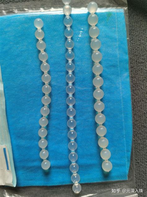 [聚焦]百科知识:珠子上一圈一圈是什么玛瑙-玛瑙珠子上面有螺旋纹「10日实时动态」 - 翡翠栏目