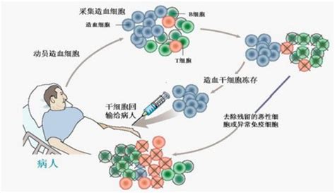 日本干细胞-干细胞移植有效改善肾病_多睦健康海外高端医疗
