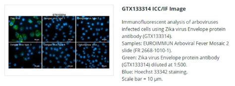 Zika virus Envelope protein antibody价格,详情介绍-960化工网 – 960化工网