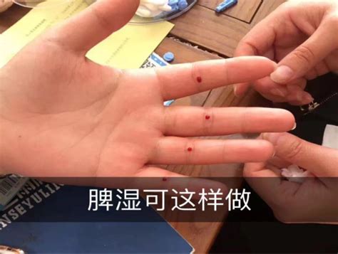 四缝的准确位置图图片 四缝的准确位置图图片
