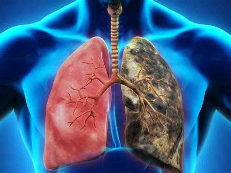 患上肺癌，除了与吸烟有关，这4个行为不改，肺迟早会受损！_凤凰网