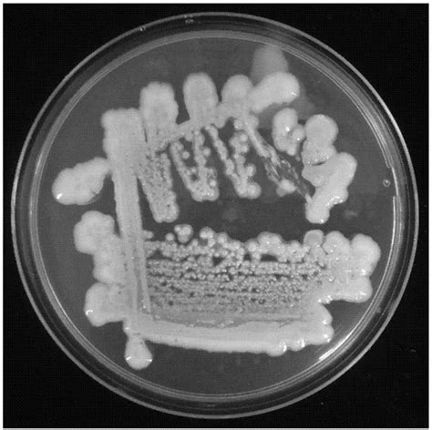 农杆菌介导香菇菌丝遗传转化体系的研究
