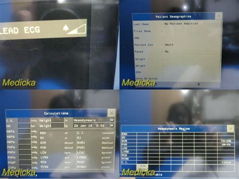 Used PHILIPS Philips Intellivue MP 70 M8007A Touch Screen Patient ...