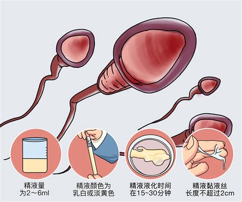 人工授精男性的精子质量重不重要-深圳中山泌尿外科医院