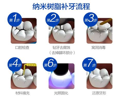 【大医口腔】10张超实用的口腔科普图解|口腔基础|陕西嘉友科贸有限公司