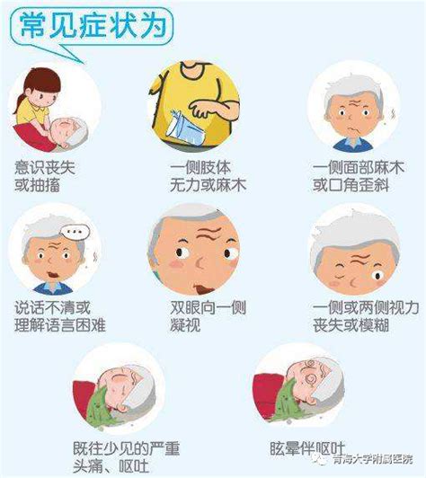 脑卒中图片