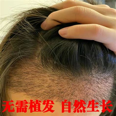 【不长我吃掉】头发自然生长速度 男女头发速度变密-淘宝网