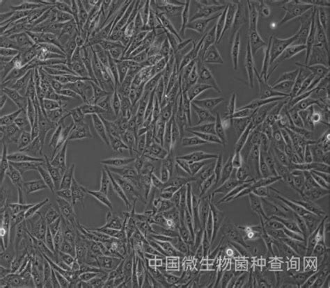 ATCC肿瘤细胞_细胞CELL_微生物菌种查询网-ATCC,菌种,质粒,细胞系