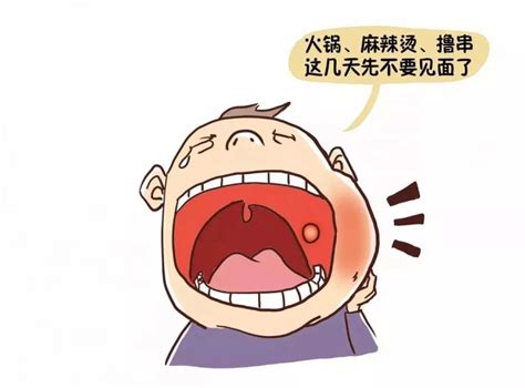 口腔上颚溃疡图片