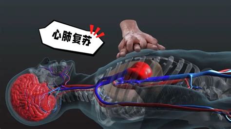 心肺复苏图片