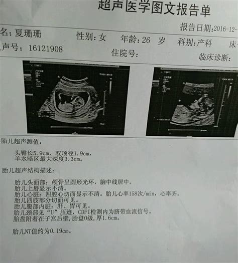 怀孕十二周零五天做NT查出无脑儿，该怎么办？