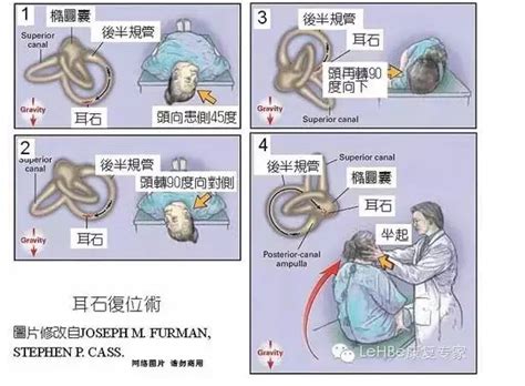 耳石症图片
