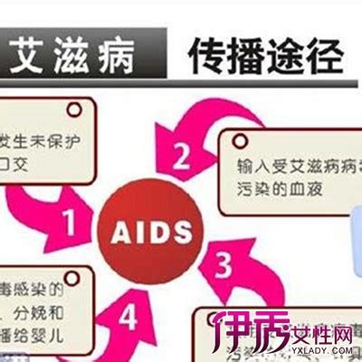 【艾滋病女传男的几率】【图】艾滋病女传男的几率有多大 一起了解艾滋病传染的机率(2)_伊秀健康|yxlady.com