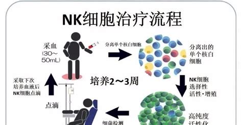 NK细胞免疫疗法,NK细胞疗法,新NK细胞治疗技术证实抗癌成功_全球肿瘤医生网