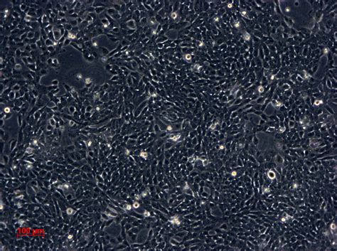 5637细胞ATCC HTB-9细胞 人膀胱癌细胞株购买价格、培养基、培养条件、细胞图片、特征等基本信息_生物风