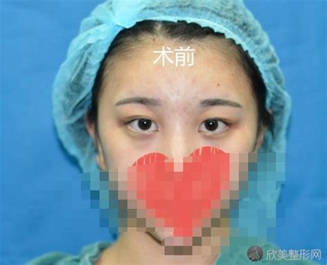 上海九院哪个医生做双眼皮较好?2021年眼部整形价格表更新-欣美整形网