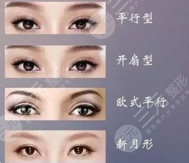 类型图片