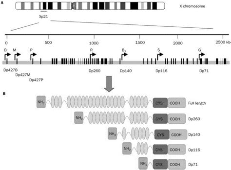 Rett综合征的临床特点及MECP2基因突变分析