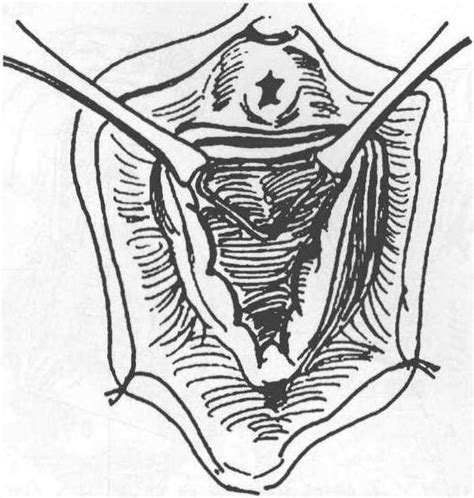 第六节 女性生殖系统 - 《人体解剖学》 - 中医世家