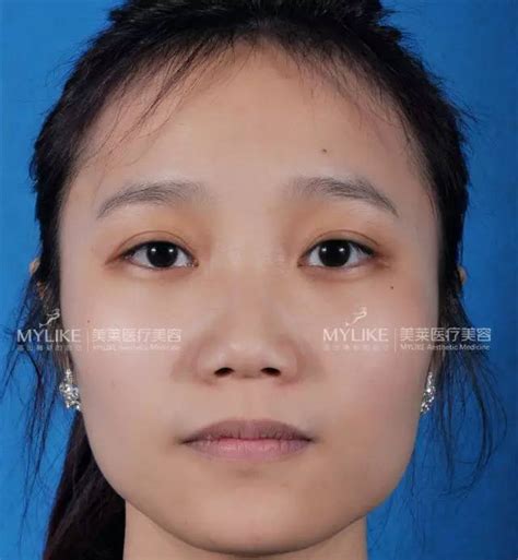 杏眼图片