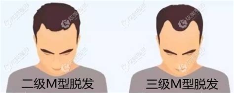 发际线高男生适合的发型 首推有刘海的发型款式_发型脸型 - 美发站