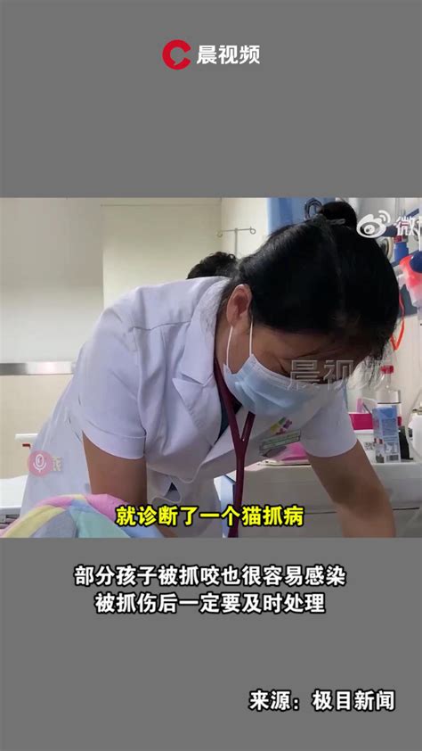 9岁女孩被猫抓伤间断高烧14天，医生：感染了猫抓病_腾讯视频