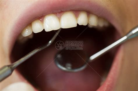 在牙医口腔检查时对口腔张开的高清图片下载-正版图片507267551-摄图网