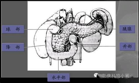 【附图】 选择性冠状动脉造影 _心脏解剖学 | 天山医学院