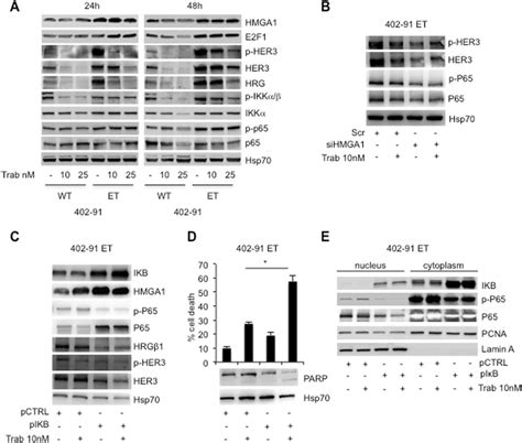 丁香苷通过FOXO3a/NF-κB通路在大鼠脑缺血模型中发挥神经保护作用