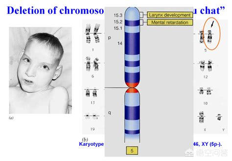 男人的染色体是XY，女人是XX，染色体是“YY”会是什么样子呢？__财经头条