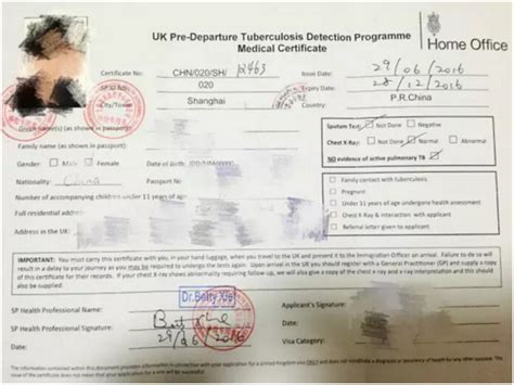 英国签证，我是否需要做肺结核检查?
