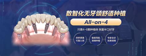 广州黄埔种植牙医院排行榜更新,穗华种牙价格不贵网评最好 - 爱美容研社