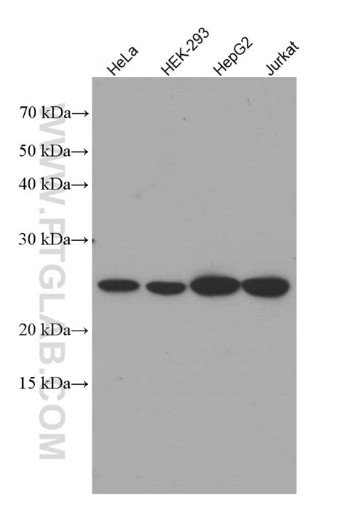 ATP5O Antibody 66696-1-Ig | Proteintech