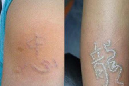 纹身老了以后的危害 纹身对身体的伤害有哪些_探秘志
