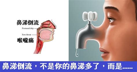 鼻炎反复发作？中医：只需这3招，清鼻通窍，呼吸畅通-京东健康