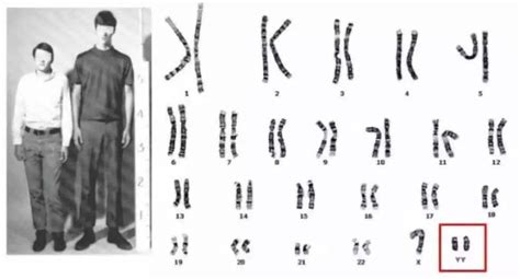 如下图中A.B表示人类体细胞染色体组成.请分析图中染色体组成并回答下面的问题. (1) 从染色体形态和组成来看.表示女性的染色体是图 .男性的 ...