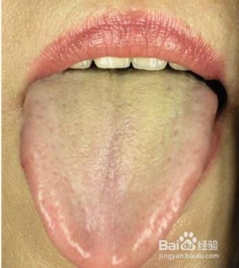 健康人的舌苔图片