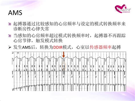 人工心脏起搏器-中国医学百科-医学