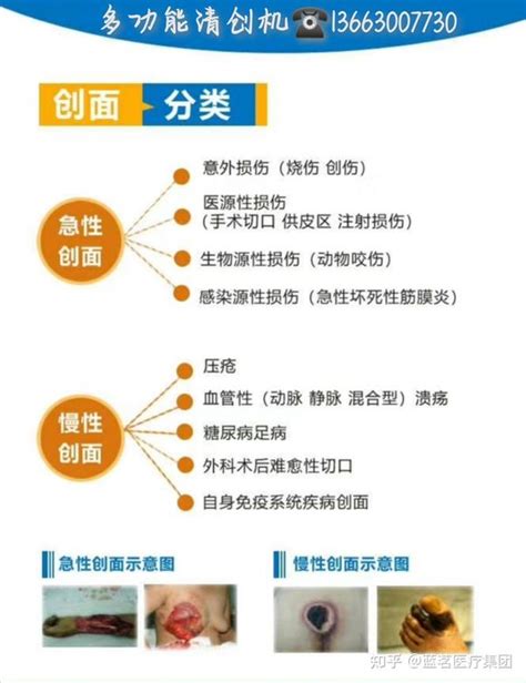 清创图片