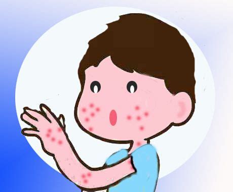 身上长“湿疹”，3种食物朋友们不要吃，容易阻碍病情恢复！__凤凰网