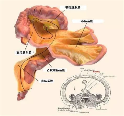 肠系膜扭转,肠系膜扭转t表现,肠系膜扭转t表现图片_大山谷图库