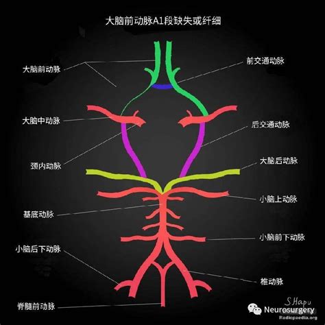颞动脉位置图片