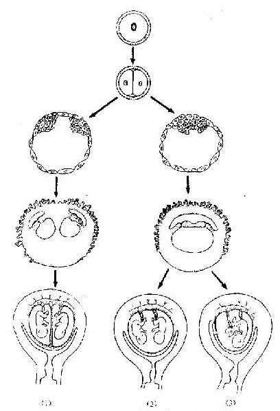 双胞胎是怎么形成的 双卵胎的成长历程_知秀网