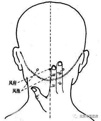 四种头痛艾灸不同位置的穴位_艾灸百科