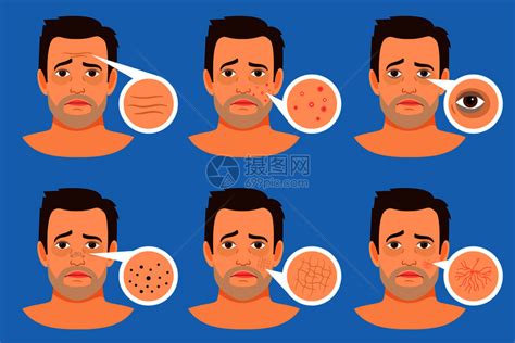 面部皮肤健康问题图片素材-正版创意图片500744690-摄图网