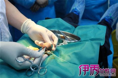 男性正常龟头图片