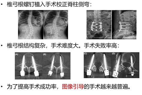 SIGMA-1脊柱侧弯三维扫描仪的3大优势-北京力泰友联科技有限公司