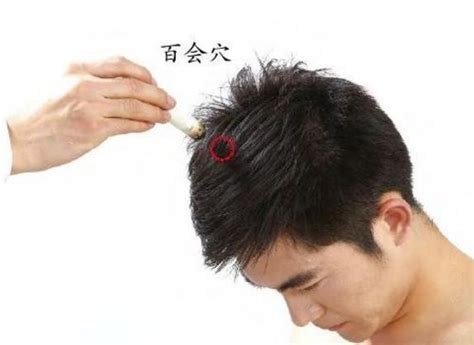 百会的准确位置图图片