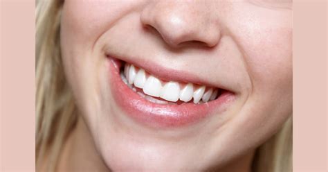 Smile secrets: 5 things your grin reveals