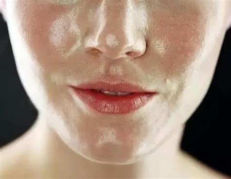 昆明皮肤管理：皮肤油腻是什么原因 - 知乎